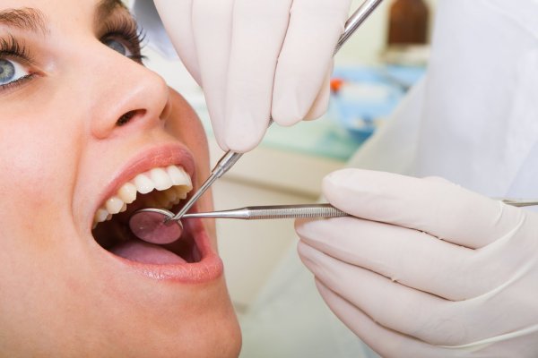 limpeza-dental limpeza-dental